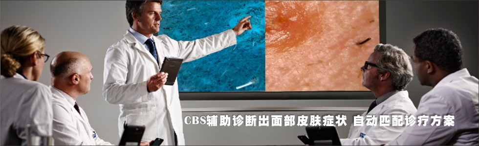 CBSƤϵͳϳ沿֢״ԶƥƷ